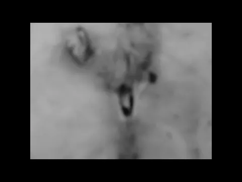 the apple core
