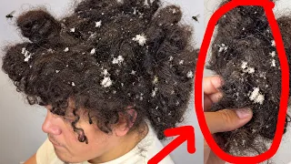 the absolute WORST hair matting I've ever seen in my career...