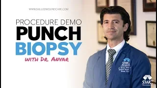 Punch Biopsy Demo - Skilled Wound Care