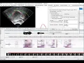 AAA219 Batch tutorial 3 Refining batch splining