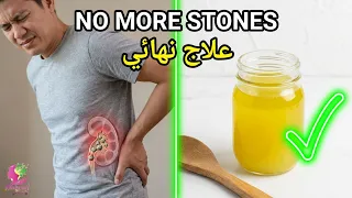 نبات يشفي كل شيء! تخلص من حصوات الكلى نهائياً بدون جراحة بهذا السر المنزلي  تنظيف الكلى من السموم
