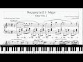 Chopin - Nocturnes Op 9 No 2 in E Flat Major