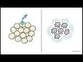 SDL 27 Acute Appendicitis Peritonitis