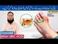 Download Lagu Treat High Uric Acid \u0026 Stomach Problems - Uric Acid Aur Pait Ki Bemario Ka Ilaj - Urdu/Hindi