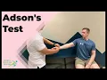 Download Lagu Adson’s Test (for Thoracic Outlet Syndrome)