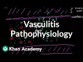 Vasculitis pathophysiology Circulatory System and Disease NCLEX-RN Khan Academy