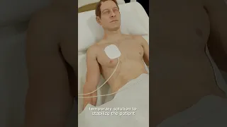 Why Transcutaneous Pacing Saves Lives in Seconds 3D Visual