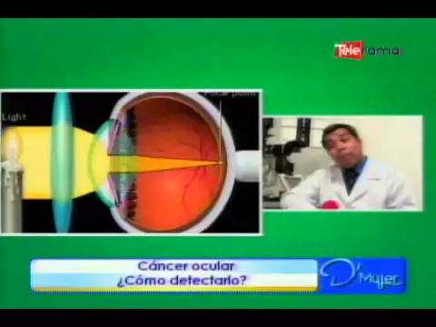 Cáncer ocular ¿Cómo detectarlo?