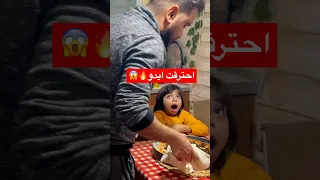 احترقت يد عموري ورحنا لمستشفى فهد الشلهومي اكسبلور Shorts Short Shortvideo 