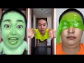 Lagu CRAZIEST Sagawa1gou Funny TikTok Compilation | Try Not To Laugh Watching Cactus Dance Challenge 2025