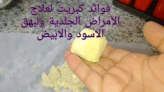 فوائد الكبريت وعلاجه البهق الجلدي وطريقة سحقيه وخلطيه واستعماله 