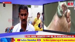  great health treatment therapy kakinada news4 india