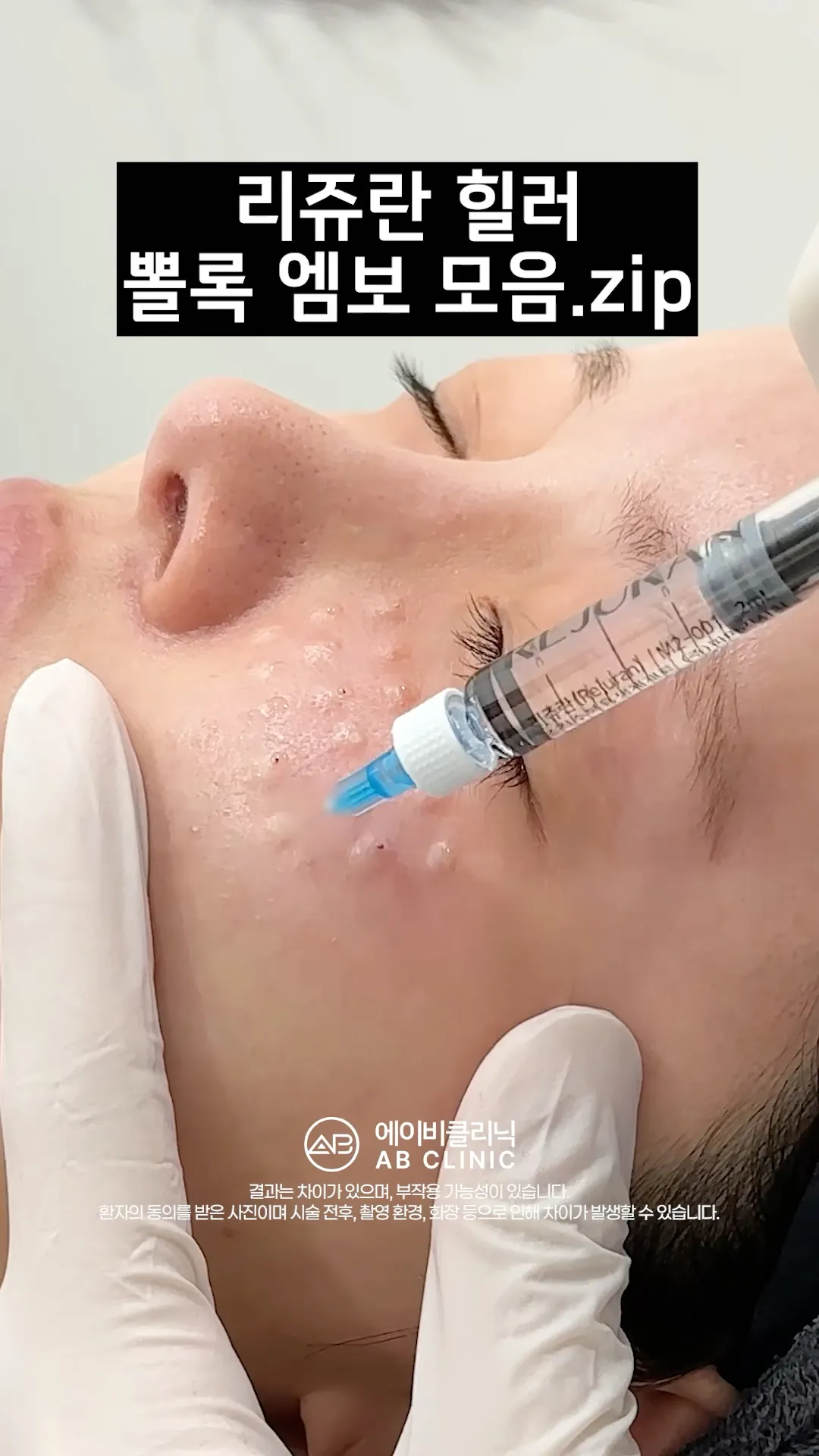 리쥬란 뽈록 엠보 모음 zip.