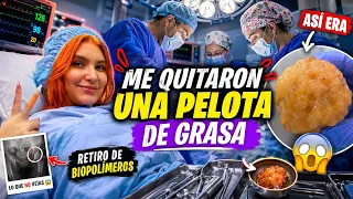ME QUITARON MEDIA NALGA // Biopolimeros 😭💔