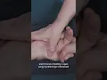 Try This Massage Technique to Help Treat Wrist Drop