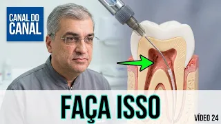 Video 25   Medicação Intracanal