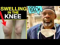 Download Lagu SWELLING IN THE KNEE | Why You Get It \u0026 How To Treat It With Orthopedic Surgeon Dr. Chris Raynor