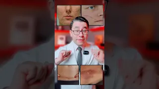 افضل جيل لعلاج اثار الجروح والحروق دندنها