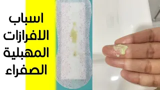 اسباب الافرازات المهبلية الصفراء دلالات نزول افرازات مهبلية صفراء مائلة للخضرة برائحة كريهة 