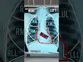 Download Lagu BEST WAY TO READ CHEST X-RAY