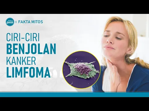 Ciri-ciri Benjolan Kanker Getah Bening atau Limfoma