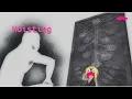 What is Hoisting in JavaScript The real explanation you always wanted