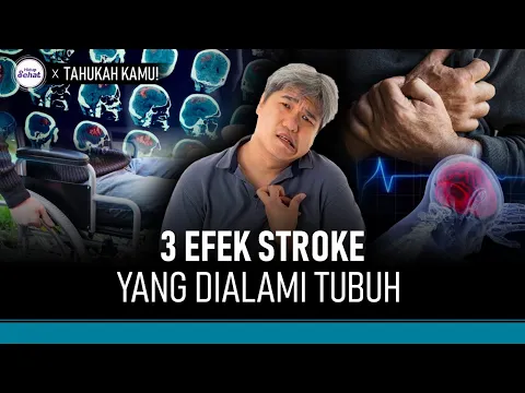 Ini 3 Hal yang Terjadi Pada Tubuh Saat Serangan Stroke