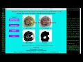 Python Code for Walnut Disease Detection Using CNN Convolutional Neural Network with Source Code