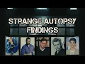 Celebrity Autopsies Shrouded in Mystery