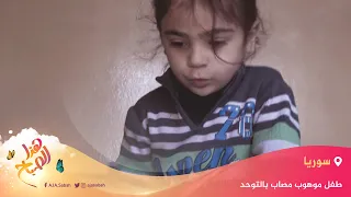 هذا الصباح طفل سوري موهوب مصاب بالتوحد يحفظ القرآن كاملا ويتعلم اللغات 