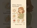 Download Lagu Signs of Ehler Danlos Syndrome You Shouldn’t Ignore!”