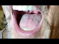 Download Lagu Ritmische tongcontracties en linker mentalis myokymische uitbarstingen bij IgLON5-IgG auto-immuniteit
