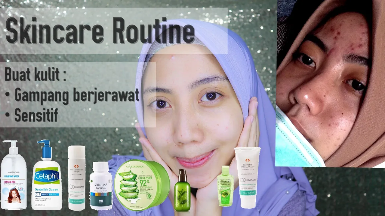 Jangan Salah ! Ini Tips Memilih Sunscreen untuk Kulit Berjerawat dan Sensitif. 
