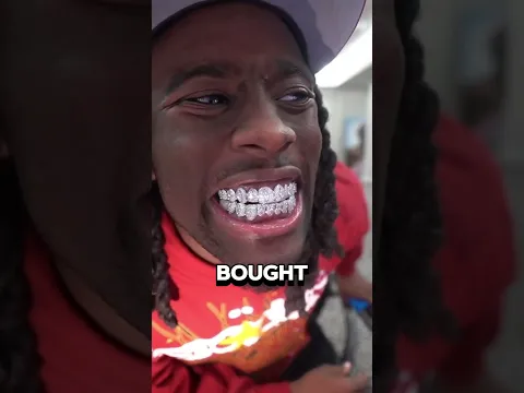 Diamond Teeth! 💎🦷