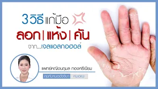  ทำไมการใช้แอลกอฮอล์เจลทามือถึงอาจทำให้มือแห้งและคันได้บ้าง 