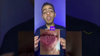                                                                                  دندنها