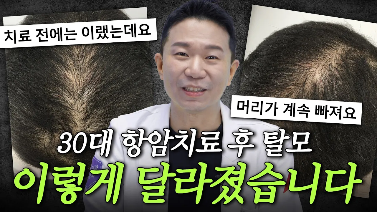 (사진O) 항암탈모 회복 사례 보여드릴게요. 이렇게 치료하면 됩니다