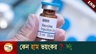 হাম সমাচার  Measles and history of measles vaccine  explained in Bangla Ep188