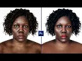 Download Lagu High End Skin Retouching | Tutorial in Photoshop #photoshop #tutorial #adobe #photoediting #shots