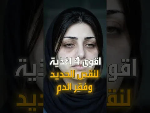 اقوى 4 اغذية تخلصك من فقر الدم ونقص الحديد! #shorts #تغذية #صحة