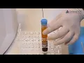 Cellenis PRP preparation process