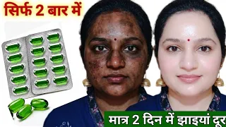 सिर्फ दो बूंद से सारी Tanning कालापन चली गई,चेहरा साफ गोरा टाइट हुआ🙈उम्र से 20 साल छोटी दिखने लगी 