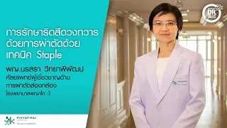 การรักษาโรคริดสีดวงทวารมีวิธีใดบ้าง ตามระยะของโรค?