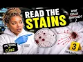 Blood Splatter on Fabric How Forensic Scientists Read the Clues