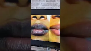 تفتيح الشفايف طبيعي 