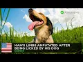Bacterial infection from dog saliva leads to lost limbs - TomoNews