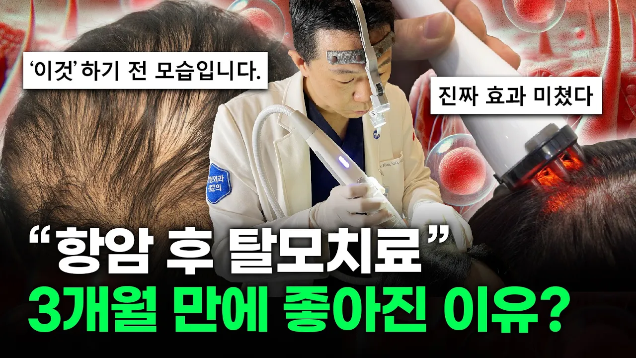 항암 후 탈모치료 "3개월 만에 이렇게 좋아질 수 있습니다"
