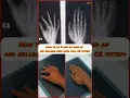 Download Lagu How to do X-ray of hand ap and oblique view with full CR system #shorts #anatomy