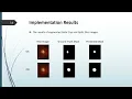 DASA2022 Attention U Net for Glaucoma Identification Using Fundus Image Segmentation