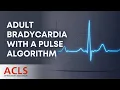 Adult Bradycardia with a Pulse Algorithm ACLS Certification Association